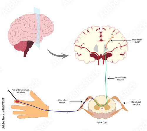 Pain Pathway. Nociception.  Ascending pathway that connect the periphery with the brain during pain and temperature sensation. Hand, spinal cord and brain.  photo