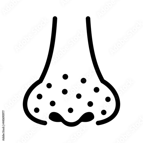 鼻の毛穴の汚れ・黒ずみのイラスト　シンプル線画　Blackheads on the nose