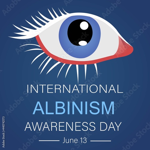 Ocular albinism eyesight symptoms vector illustration. International albinism awareness day template. June 13 albinism awareness day.