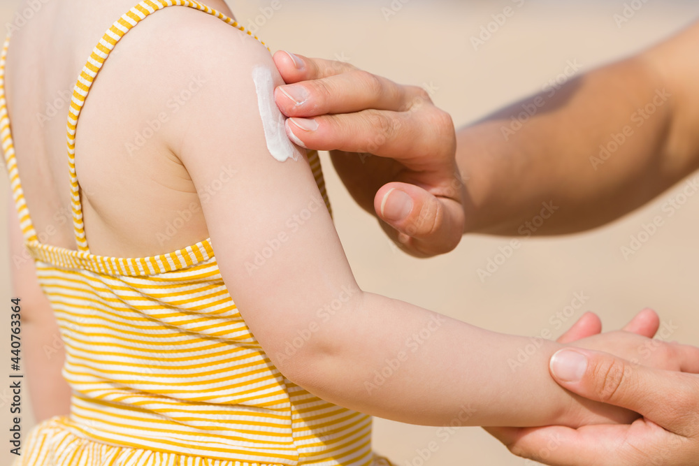 Young mother hand applying sunscreen lotion on little girl shoulder. Skin protection. Safety sunbathing in hot sunny day at beach. Side view. Closeup.