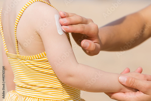 Schilderij op canvas Young mother hand applying sunscreen lotion on little girl shoulder