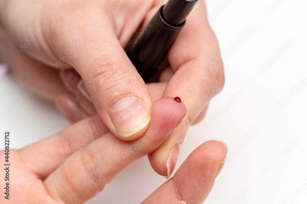 Taking blood for diabetes sugar level medical test from finger