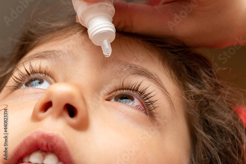 treatment, using therapeutic, medical eye drops for a child with conjunctivitis photo