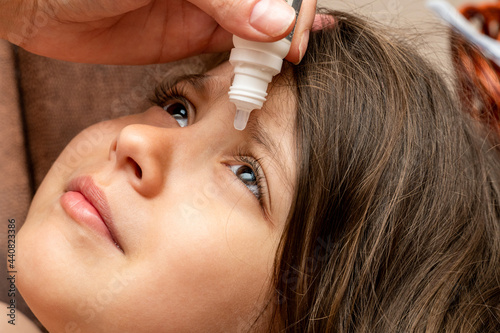 treatment, using therapeutic, medical eye drops for a child with conjunctivitis