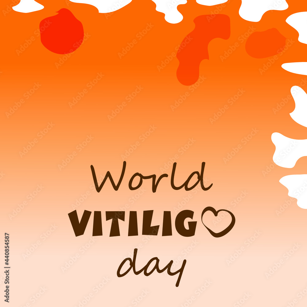 Square abstract background like skin of people with vitiligo. June 25 - World Vitiligo Day. Flat style vector