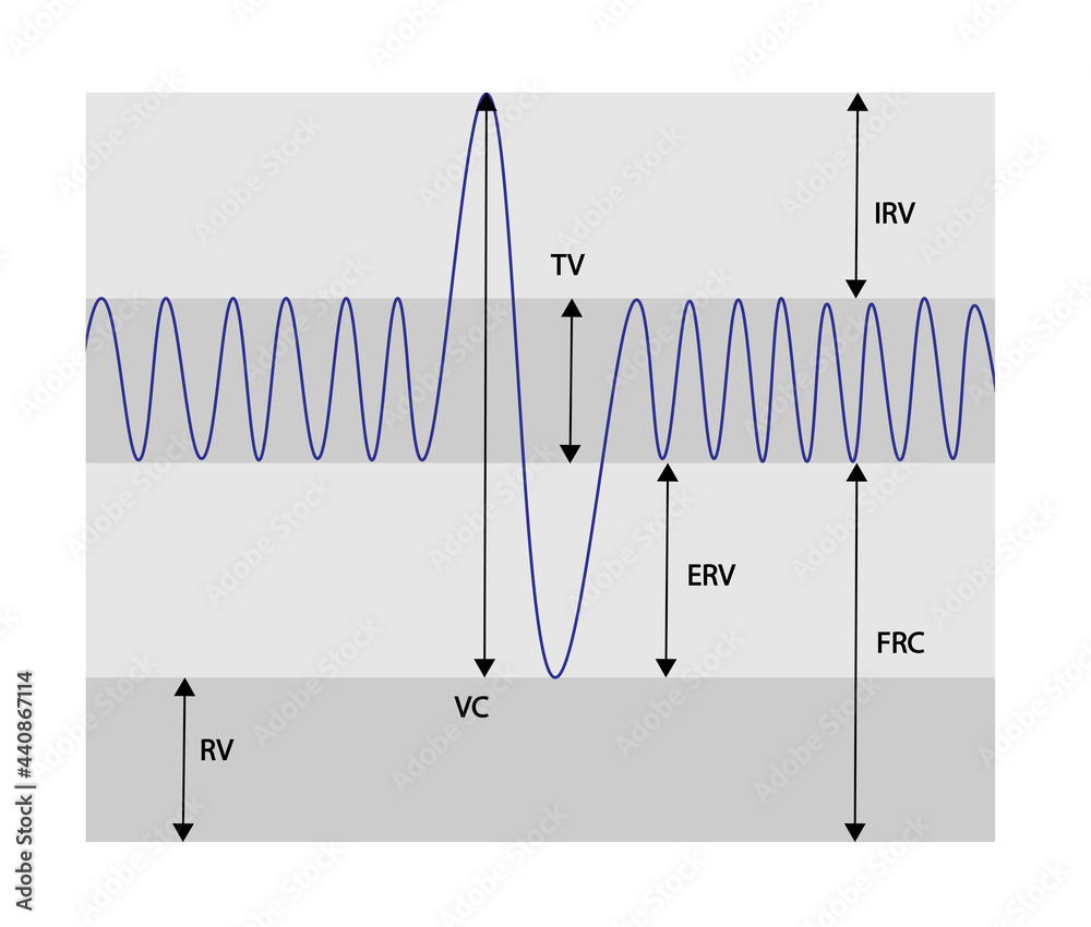 Spirometry Curve analyses. Illustration of spirometry curves. Stock ...