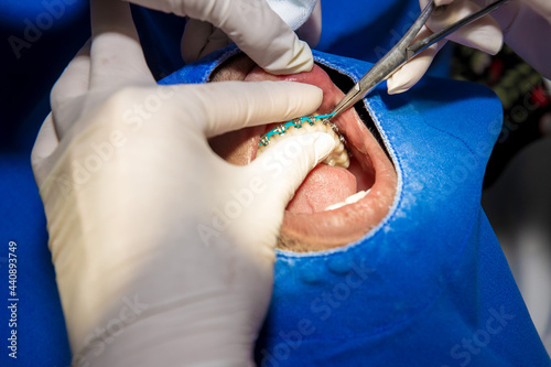 Orthodontics in dental clinic