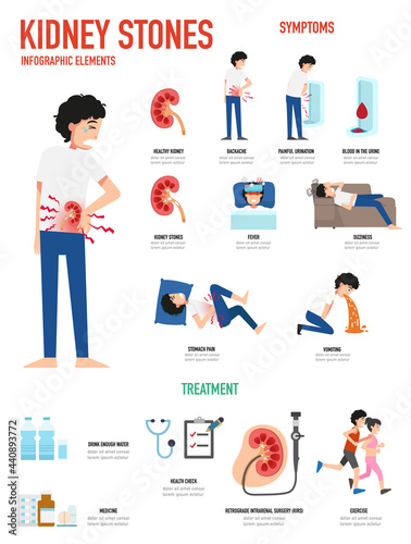 kidney stones infographic vector illustration