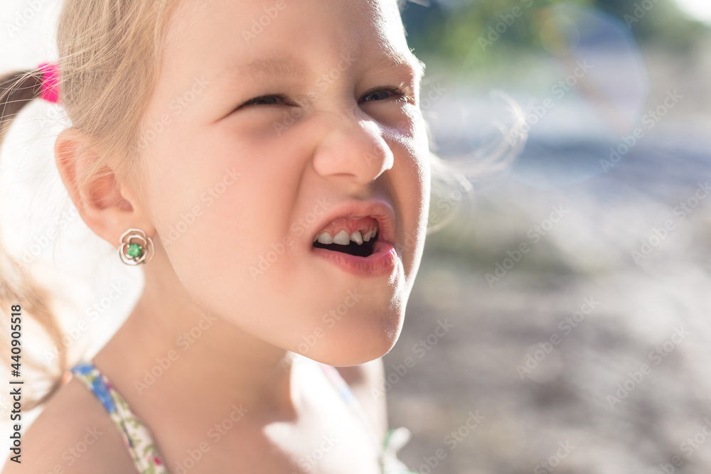 Cute little baby opened her mouth and showed wobbly baby tooth. Cute little baby opened her mouth and showed wobbly baby tooth.
