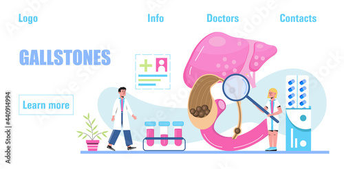 Gallbladder concept vector. Doctors treat gallstones. Biliary dyskinesia