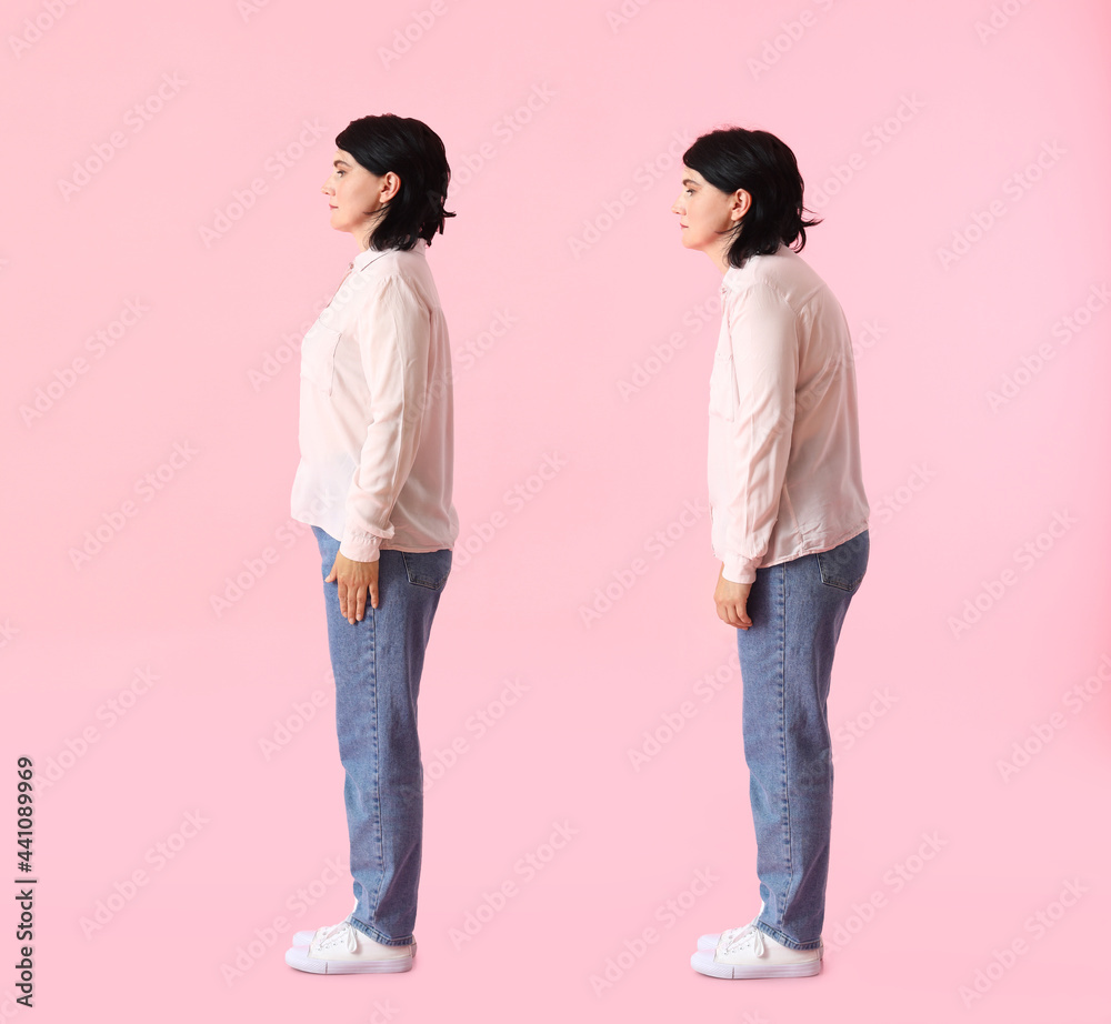 Mature woman with bad and proper posture on color background - obrazy, fototapety, plakaty 