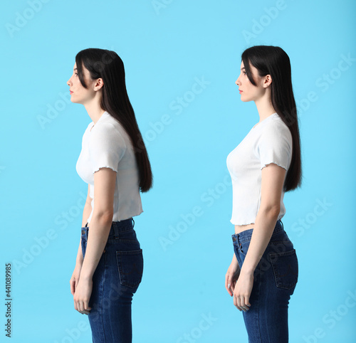 Young woman with bad and proper posture on color background photo
