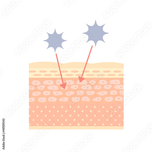バリア機能が低下している肌のイメージ