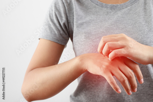 Принти на полотні Health problems, woman has itchy hands