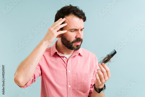 Foto Troubled man suffering from alopecia