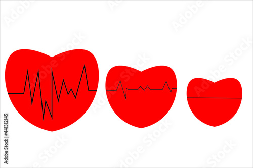A healthy heart, a pulse of pulsation, lined up to a heart whose pulse was declining.