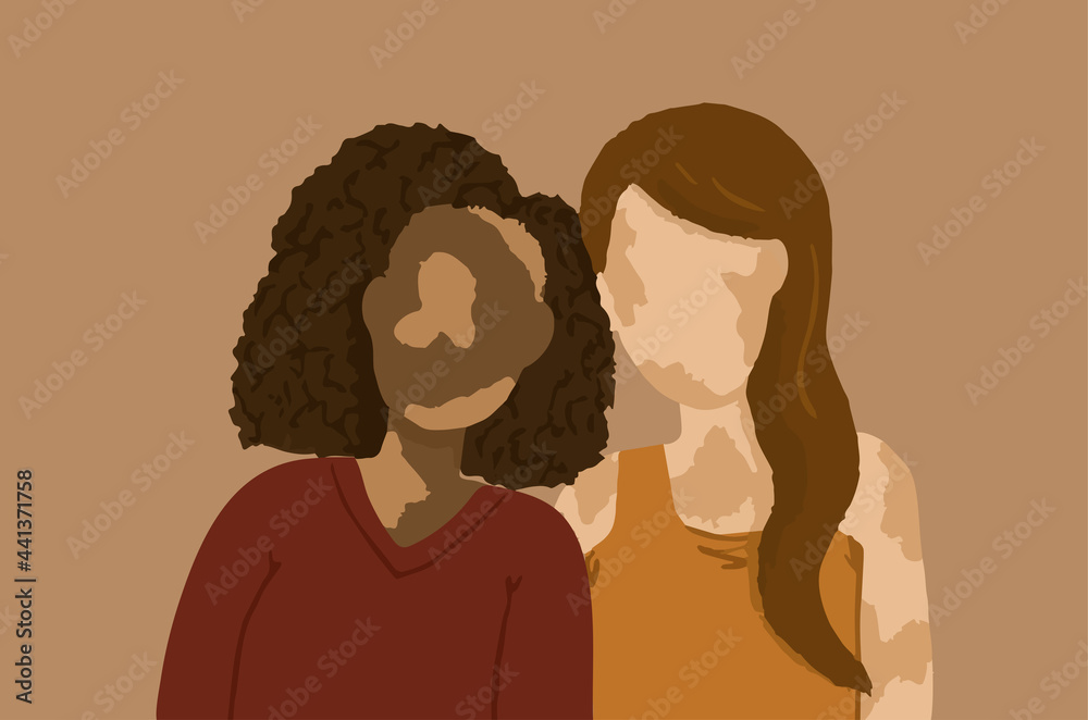 Hand drawn vector illustration of two adult women with vitiligo.