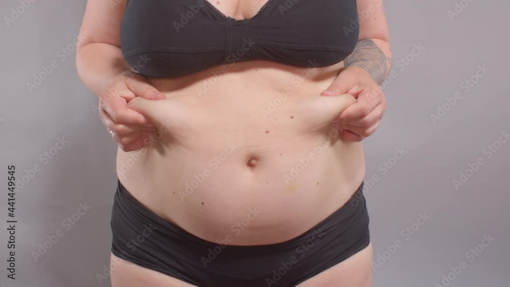 Fatty deposits on the abdomen of a woman after childbirth. She touches the folds of fat with her hands, lifts them. Stretching the skin during weight gain. Increase body volume. Fatty deposits on the abdomen of a woman after childbirth. She touches the folds of fat with her hands, lifts them. Stretching the skin during weight gain. Increase body volume.