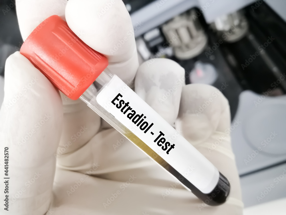 Blood sample for estradiol hormone test,