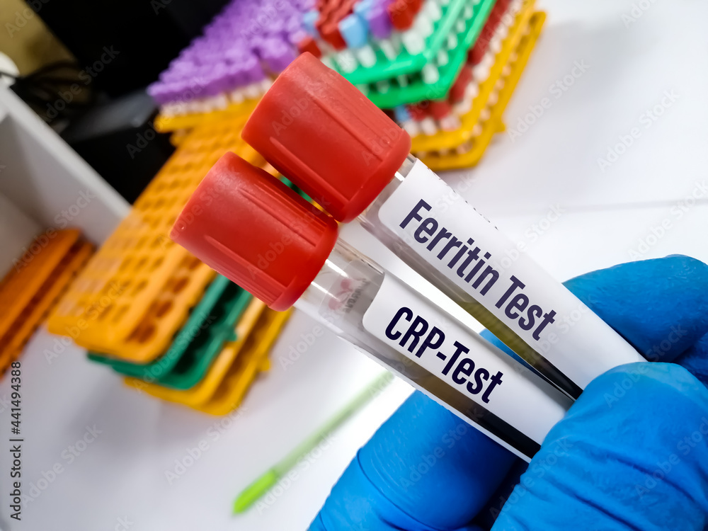 Test tube with blood sample for ferritin and CRP test Stock Photo