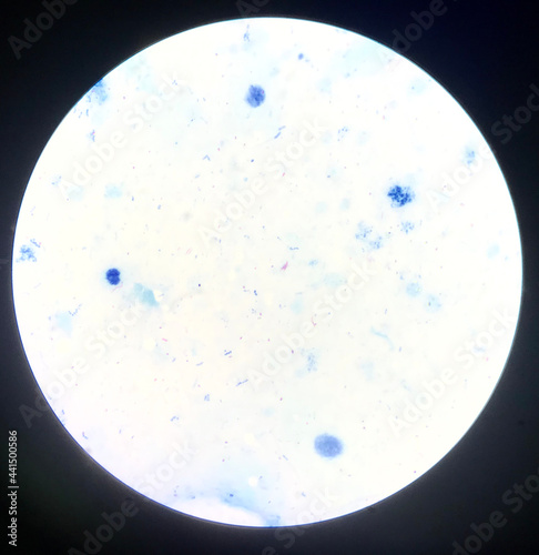 Bacteria cell in Gram stain.