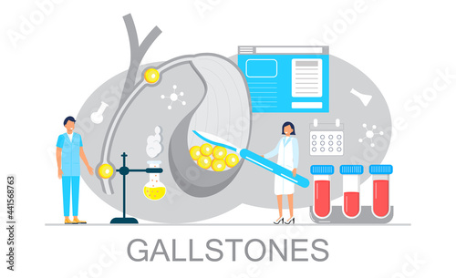 Gallbladder concept vector. Doctors treat gallstones. Web, landing page