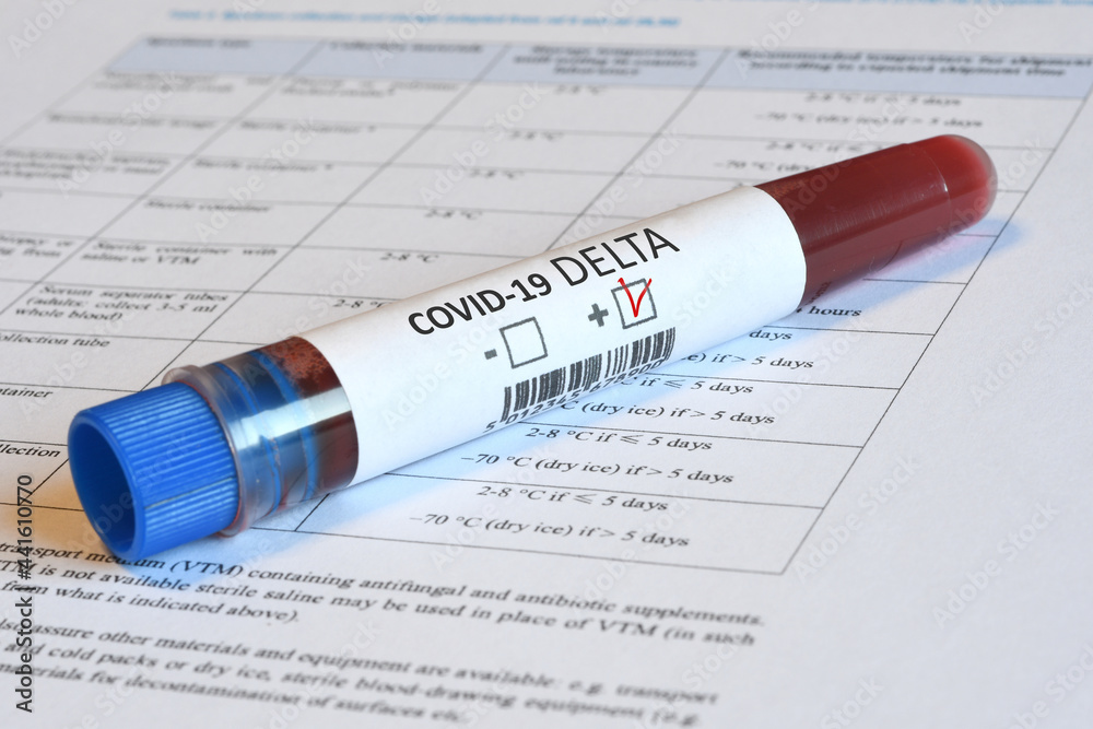 Blood tube for test detection of virus Covid-19 Delta Variant with positive result on papers document. Blood tube for test detection of virus Covid-19 Delta Variant with positive result on papers document.