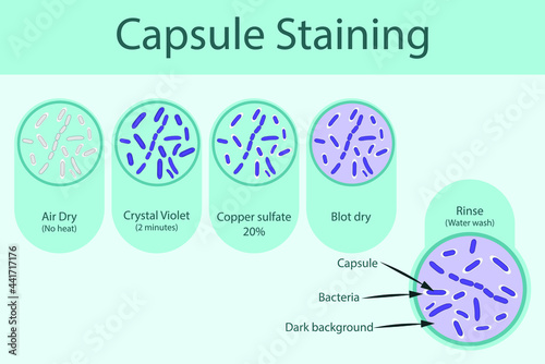 Capsule staining technique steps diagram, using Crystal violet and copper sulfate vector illustration eps10