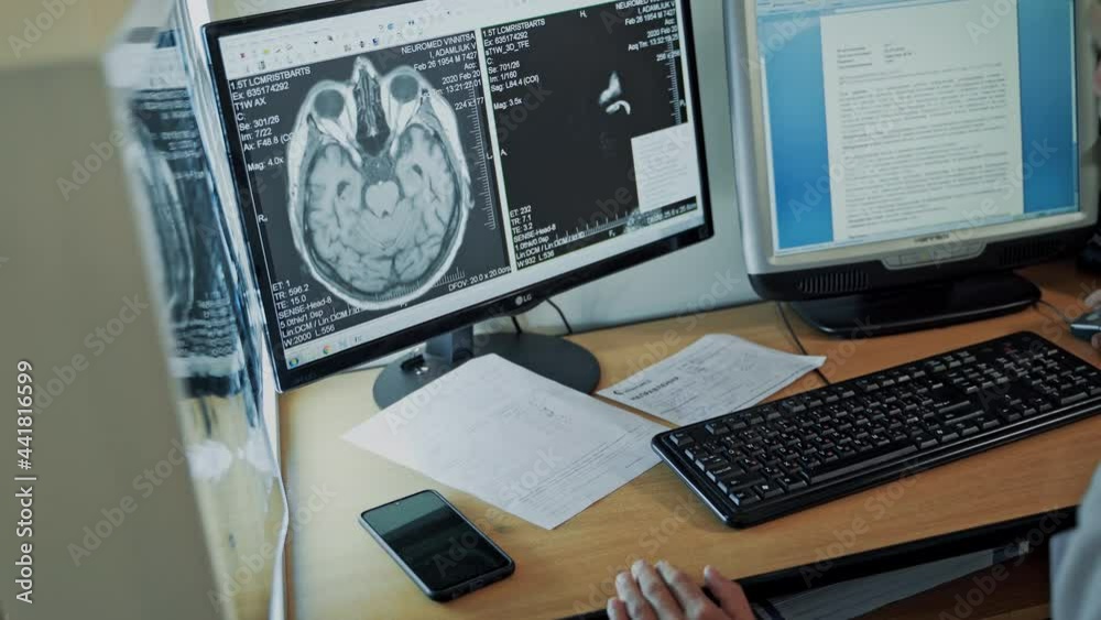 Early diagnosis, medical science development Early diagnosis, medical science development