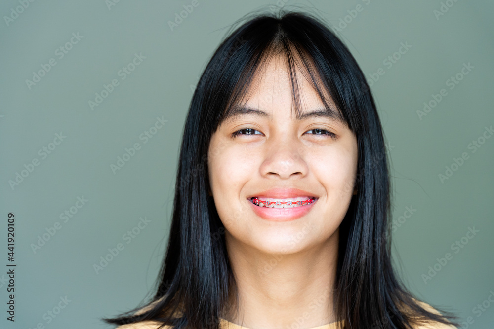 Dental Brace Girl Smiling and Looking to Camera, She Feel Happy and Have Good Attitude with Dentist. Motivate Kids not Fear When they have to go to Dental Clinic. Dental Brace Girl Smiling and Looking to Camera, She Feel Happy and Have Good Attitude with Dentist. Motivate Kids not Fear When they have to go to Dental Clinic.