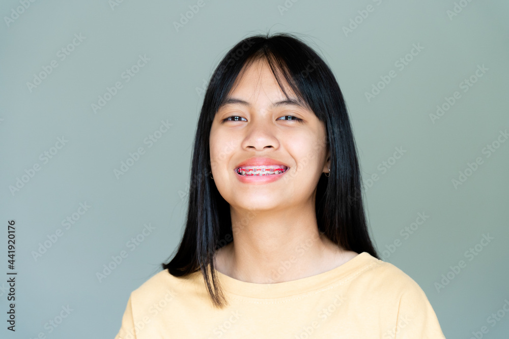 Dental Brace Girl Smiling and Looking to Camera, She Feel Happy and Have Good Attitude with Dentist. Motivate Kids not Fear When they have to go to Dental Clinic. Dental Brace Girl Smiling and Looking to Camera, She Feel Happy and Have Good Attitude with Dentist. Motivate Kids not Fear When they have to go to Dental Clinic.