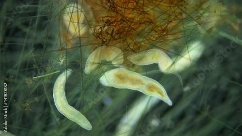 Colony Microstomum lineare and one Macrostomum sp. worms under a microscope, Family Microstomidae and Macrostomidae, Platyhelminthes Phylum. They swim among the seaweed photo
