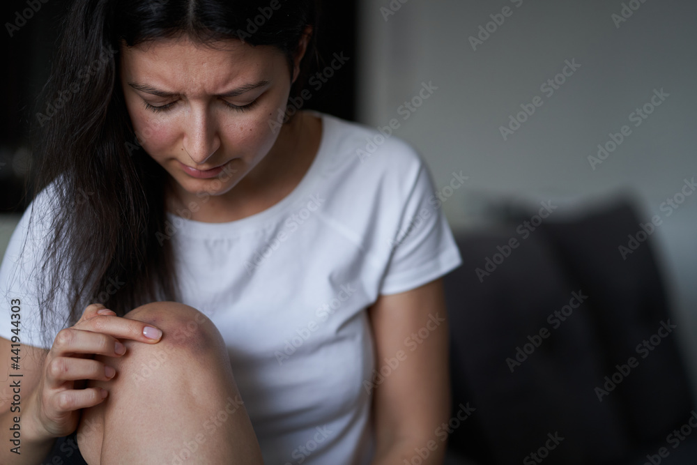 Close-up of a person massaging an injured knee joint. Bruise on the knee. Leg pain Close-up of a person massaging an injured knee joint. Bruise on the knee. Leg pain