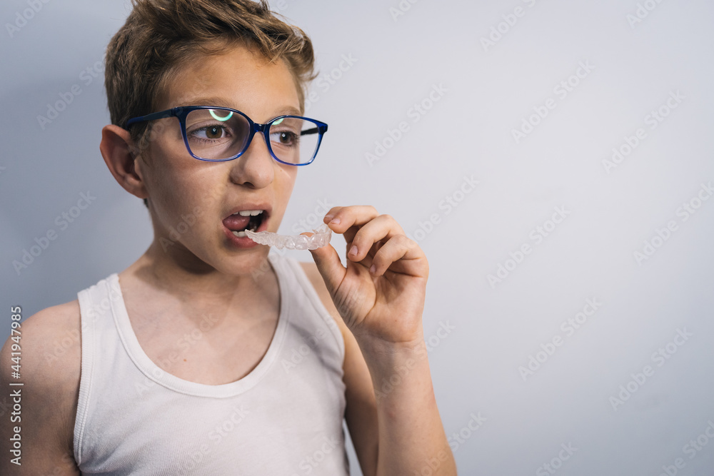 blond guy with glasses gets clear mouth braces blond guy with glasses gets clear mouth braces