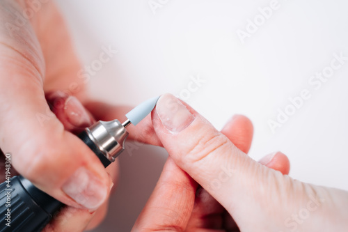 Home manicure. In the photo  a woman removes the top layer of the nail plate using a nail cutter.
