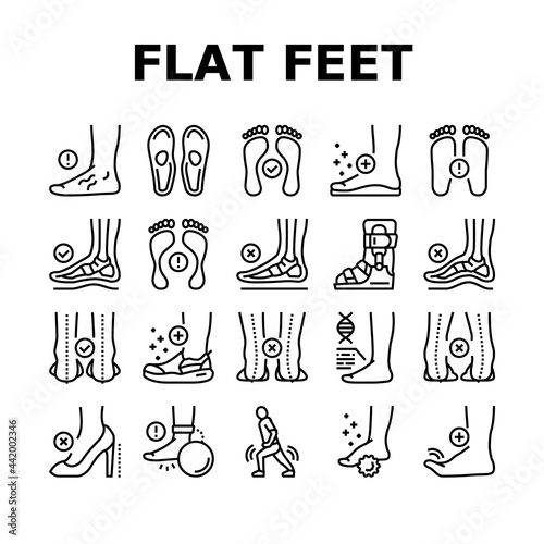 Flat Feet Disease Collection Icons Set Vector. Orthopedic Insoles And Shoes, Inward And Outward Curvature Of Legs, Flat Feet Treatment Black Contour Illustrations