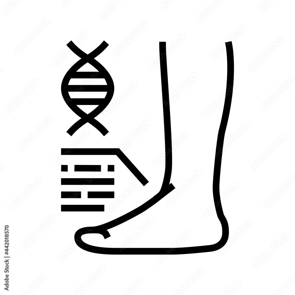 flat feet disease line icon vector. flat feet disease sign. isolated contour