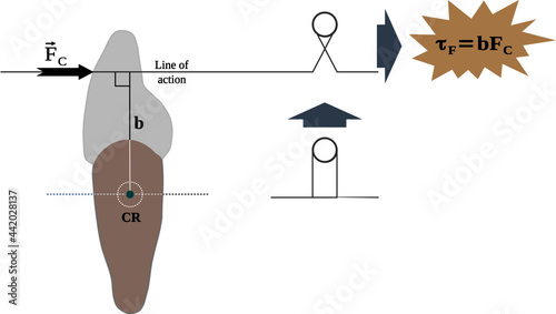 Orthodontic forces on the dental crown and the resultant torque