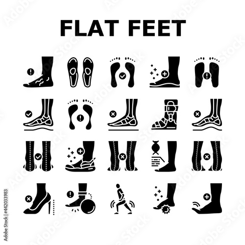 Flat Feet Disease Collection Icons Set Vector. Orthopedic Insoles And Shoes, Inward And Outward Curvature Of Legs, Flat Feet Treatment Glyph Pictograms Black Illustrations