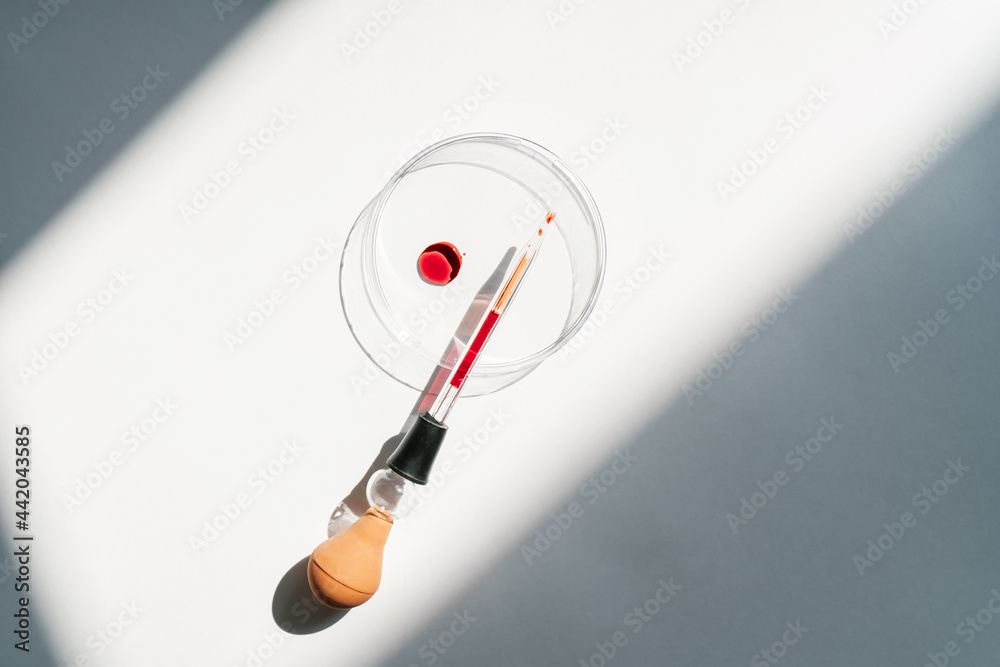 The hand holds a test tube with blood. The hand holds a test tube with blood.