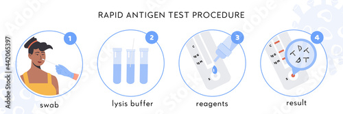 Covid-19 Rapid Antigen test procedure Infographic. A doctor takes nasal swab from african female patient. Coronavirus swap sample in lysis buffer, strip with reagents, result with antigen molecules. 