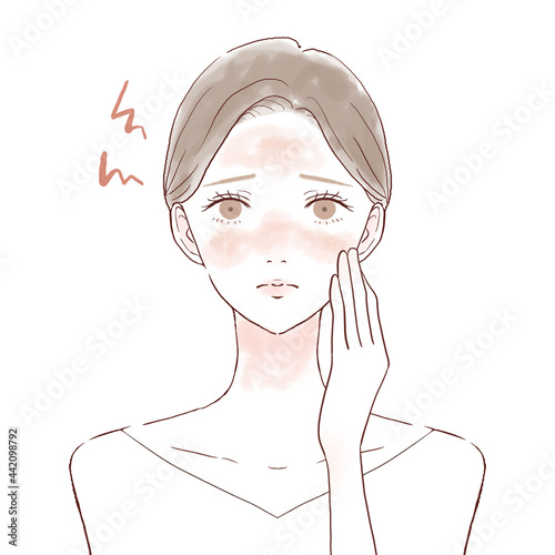 肌の炎症に悩む女性