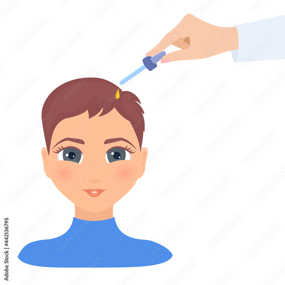 Applying hair care oil essence to woman scalp. Pipette with medicine for alopecia and baldness. Remedy for hair loss treatment. Hand holding glass dropper with cosmetic serum. Vector illustration. Applying hair care oil essence to woman scalp. Pipette with medicine for alopecia and baldness. Remedy for hair loss treatment. Hand holding glass dropper with cosmetic serum. Vector illustration.