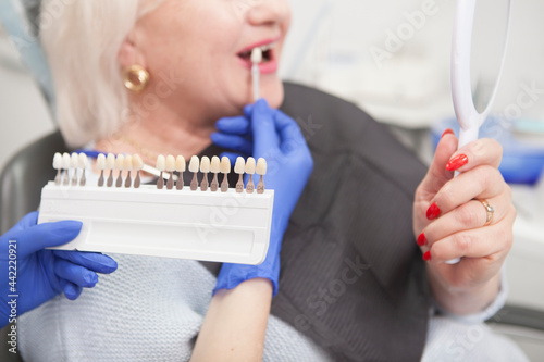 Selective focus on teeth whitening shade chart in the hand of dentist, senior woman looking in the mirror on background