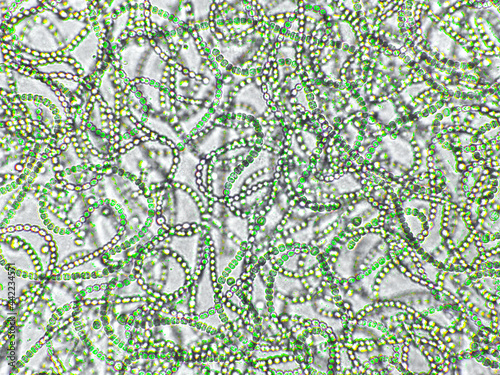 Nostoc sp. algae under microscopic view, Cyanobacteria, Blue green algae photo