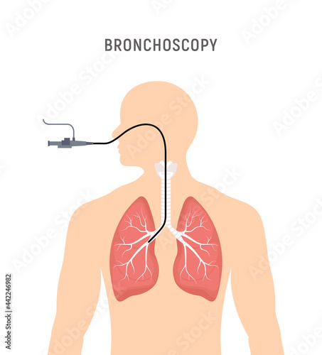 Bronchoscopy respiratory system emphysema endoscopy human lung examination. Bronchoscopy icon