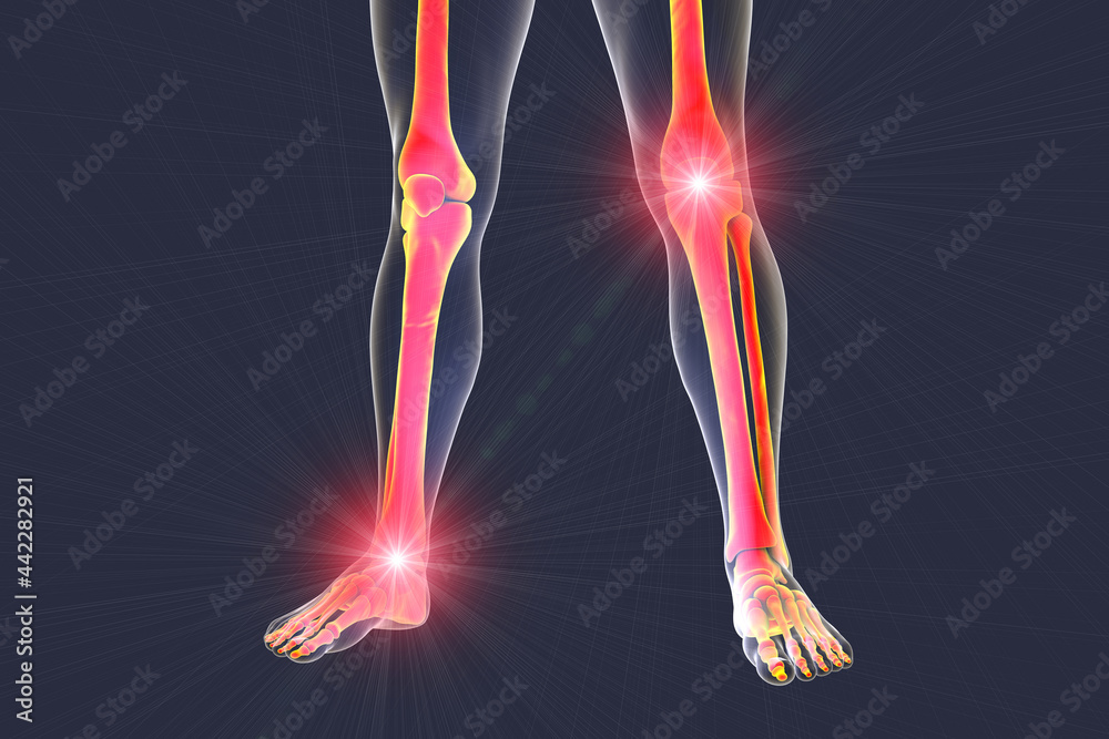 Foot and knee pain, 3D illustration. Foot and legs anatomy