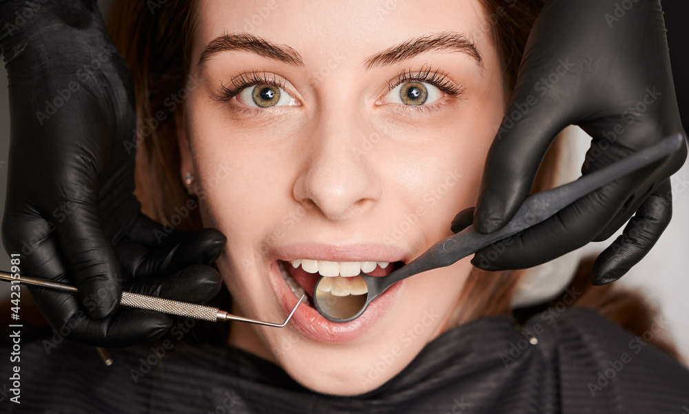Close up of dentist hands examining woman teeth with dental mirror and