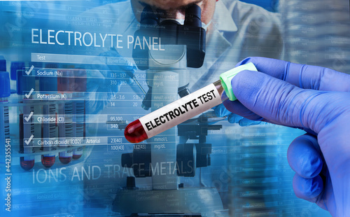 Blood sample for analysis and measurement of electrolyte and carbon dioxide levels in the patient. Technician with blood sample for electrolyte imbalance test. Protocol with values of range of results photo