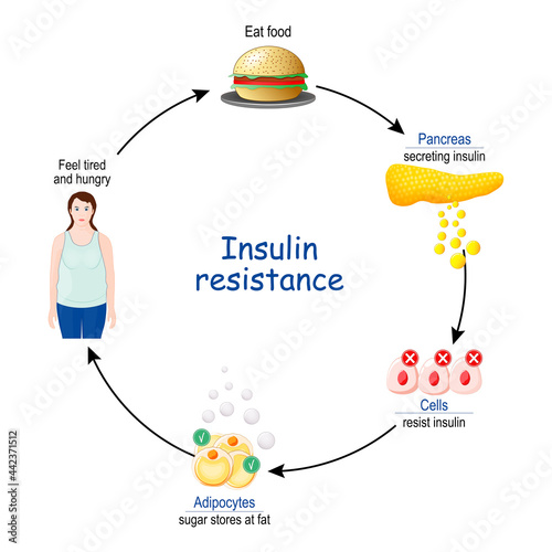 Insulin Resistance. cycle of insulin and glucose